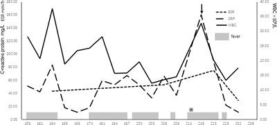 Case Report: Immune reconstitution inflammatory syndrome after hematopoietic stem cell transplantation for severe combined immunodeficiency